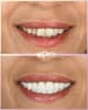Slider image (10) Perla Dental Centre